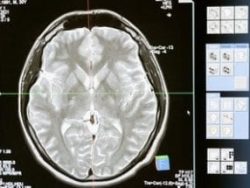 The Brain Function